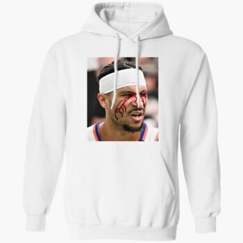 Josh Hart After Getting Elbowed In The Face Shirt